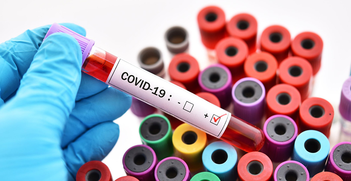 Реабилитация после Covid-19